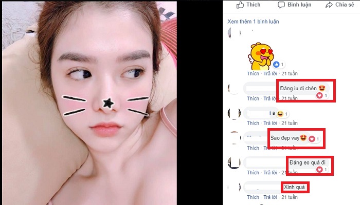 Cắt mí mắt