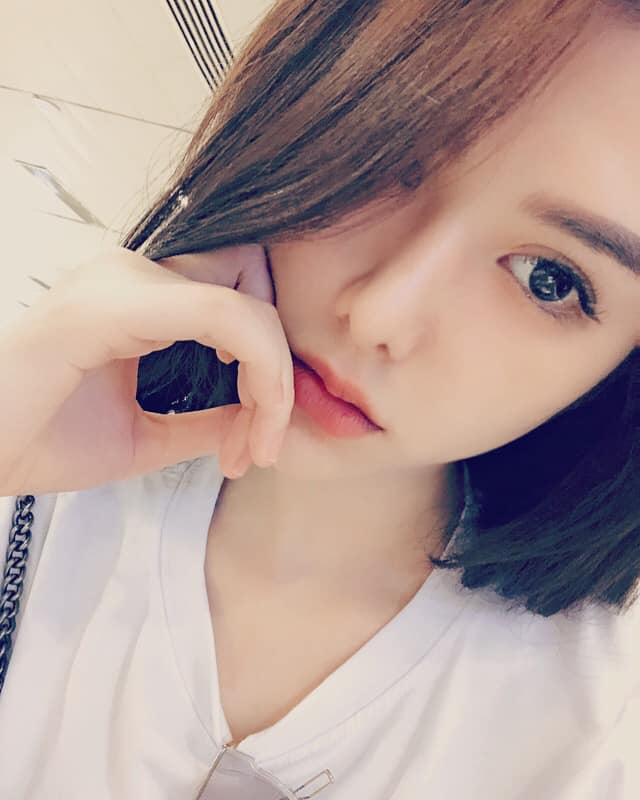 Cắt mí mắt