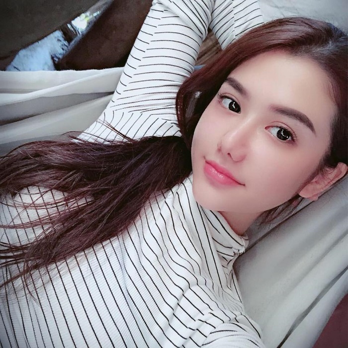 Cắt mí mắt