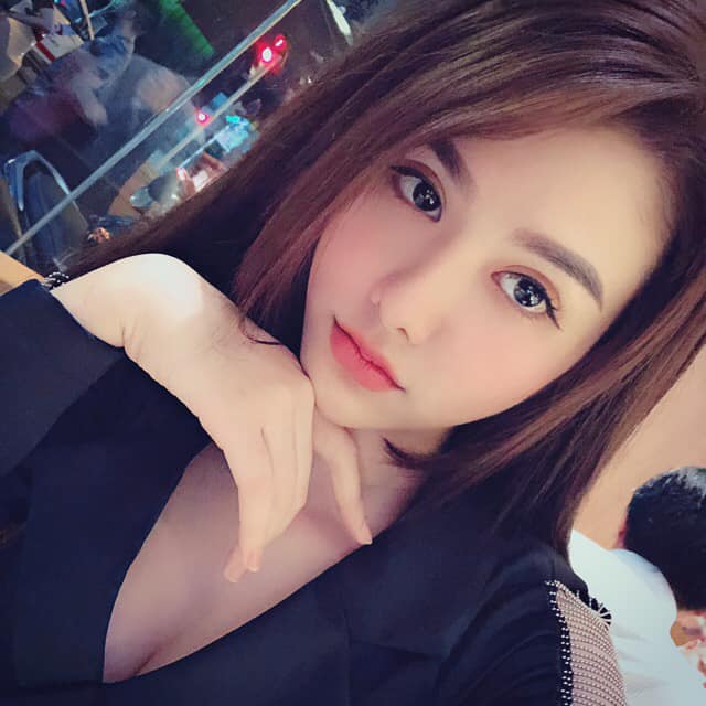 Cắt mí mắt