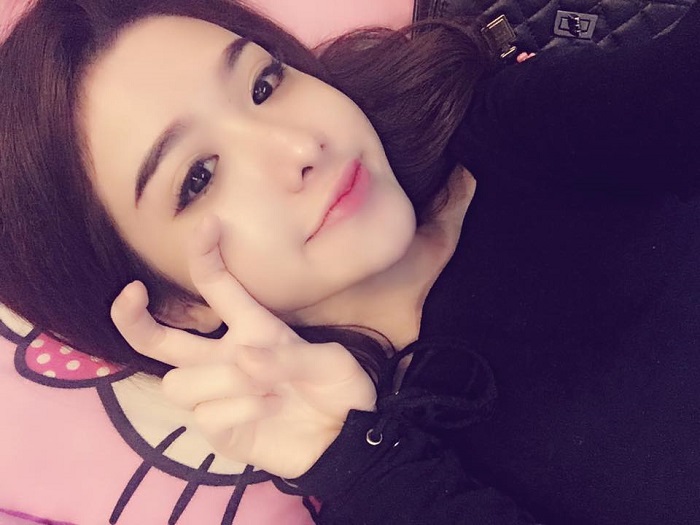 Cắt mí mắt
