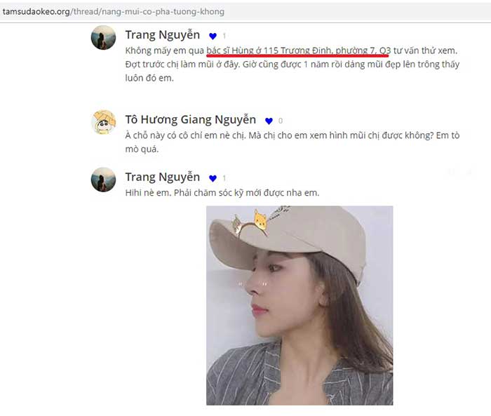 Nâng mũi Hàn Quốc ở Hà Giang