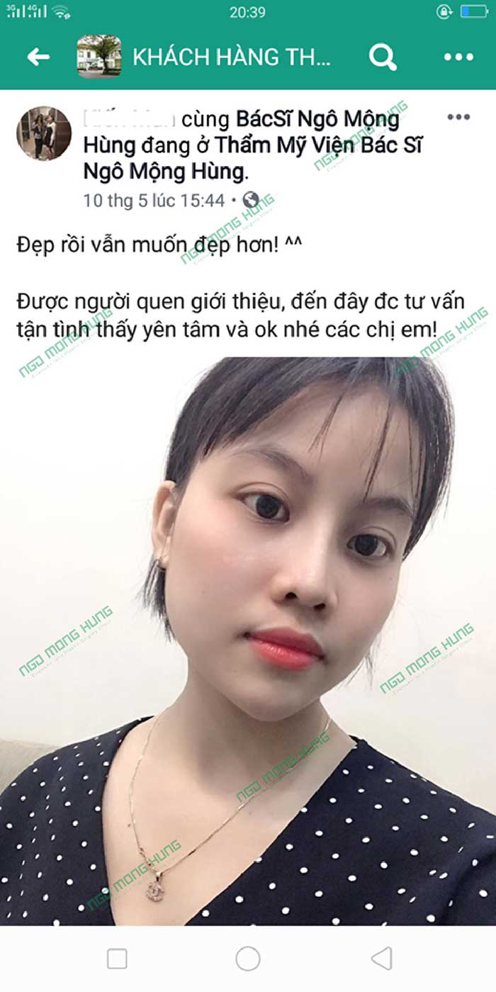 Sửa mũi Hàn Quốc ở Mỹ