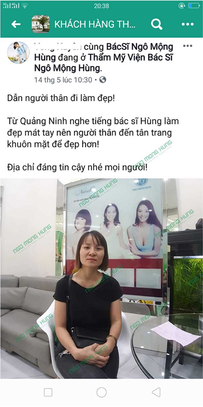 Cây nâng mũi Hàn Quốc