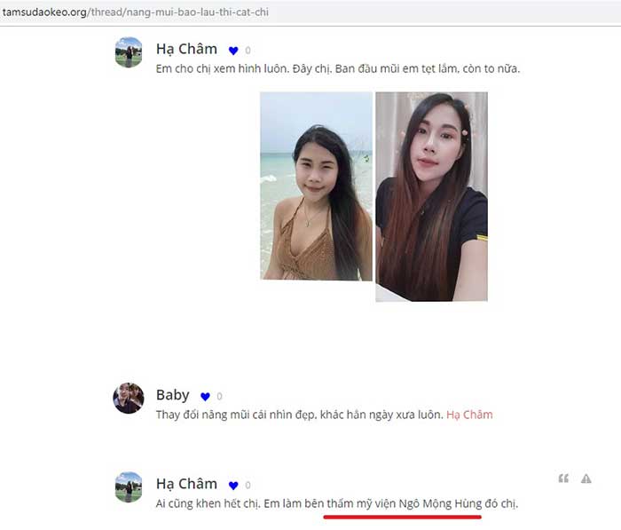 Nâng mũi Hàn Quốc ở Bắc Giang