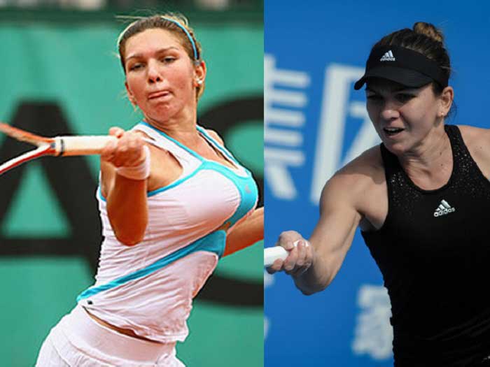Simona Halep phẫu thuật ngực