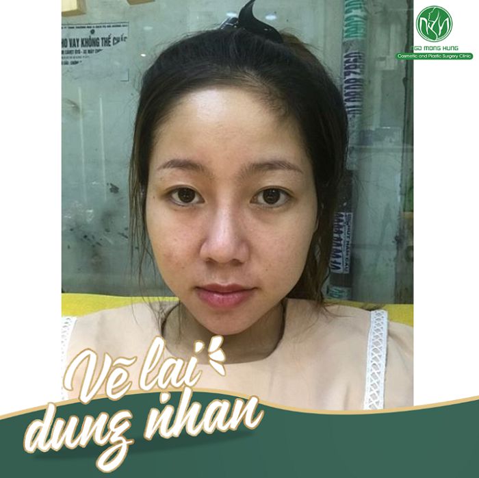 Vẽ lại dung nhan 2019 - Nhật ký 30 ngày“Vịt hóa thiên nga” của cô sinh viên trẻ Mỹ Tiên