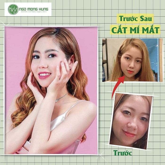 Vẽ lại dung nhan 2019 - Nhật ký 30 ngày“Vịt hóa thiên nga” của cô sinh viên trẻ Mỹ Tiên