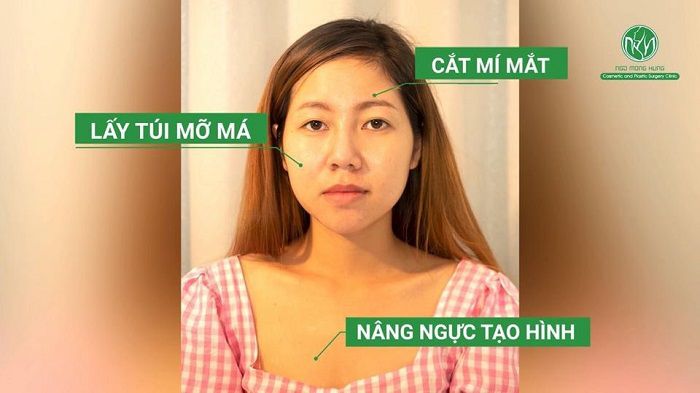 Vẽ lại dung nhan 2019 - Nhật ký 30 ngày“Vịt hóa thiên nga” của cô sinh viên trẻ Mỹ Tiên