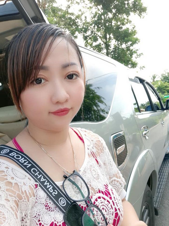 Quá trình cắt mí mắt của khách hàng Huỳnh Thị Thanh Hằng