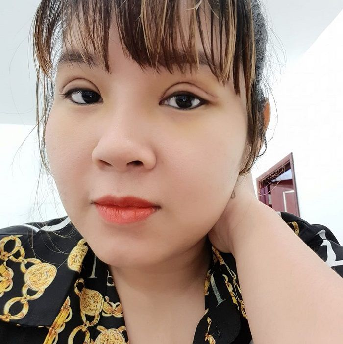 4. Phẫu thuật có điểm dừng, cô gái nhận được thành quả xứng đáng sau khi cắt mí mắt 