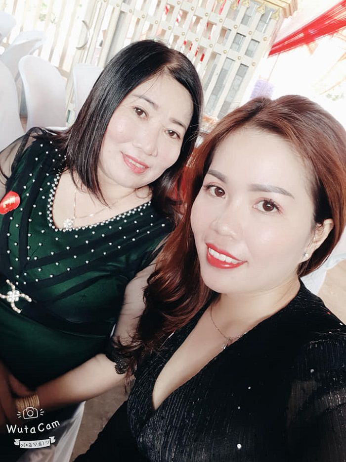 Cắt mí mắt: cô gái quê mùa lột xác sang chảnh bất ngờ