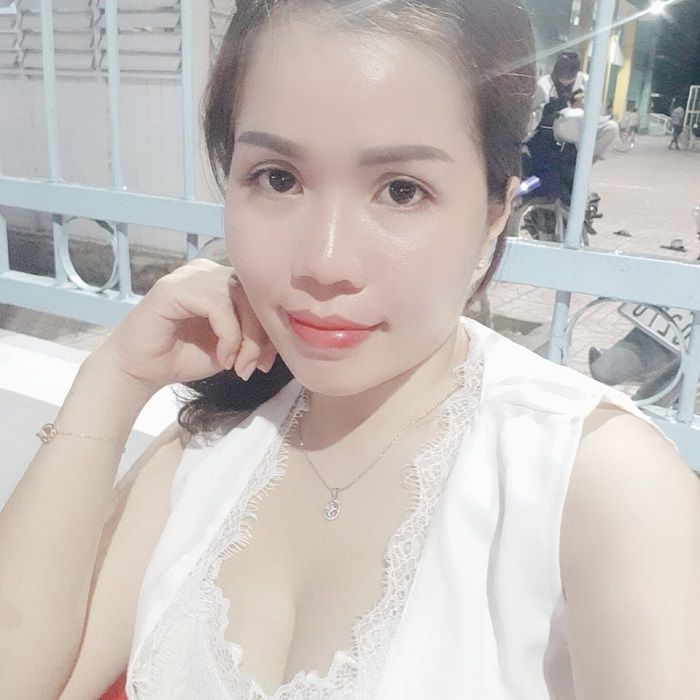 Cắt mí mắt: cô gái quê mùa lột xác sang chảnh bất ngờ