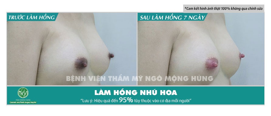 Kem làm hồng núm vú