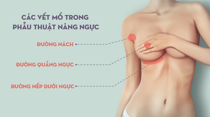Áo nâng ngực không dây giá bao nhiêu