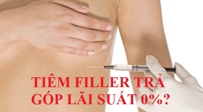 Tiêm filler trả góp