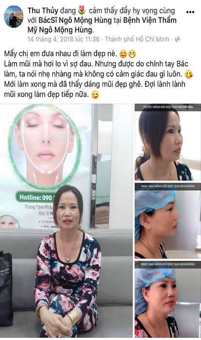 Nâng mũi ở Hà Tĩnh