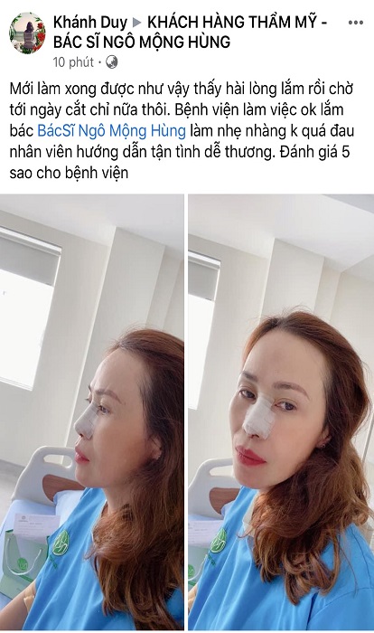Nâng mũi ở Lạng Sơn