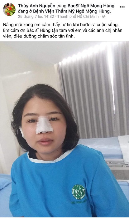 Nâng mũi ở Hà Tĩnh