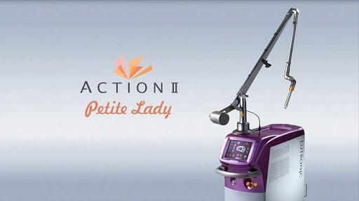 Bài tập thu nhỏ vùng kín - Công nghệ Laser