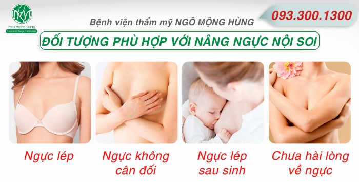 Nâng ngực bằng Aqualifit Filler