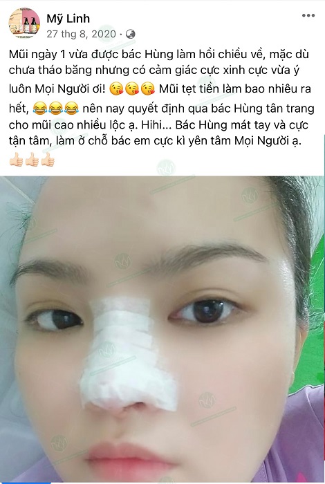 Mũi tẹt là gì