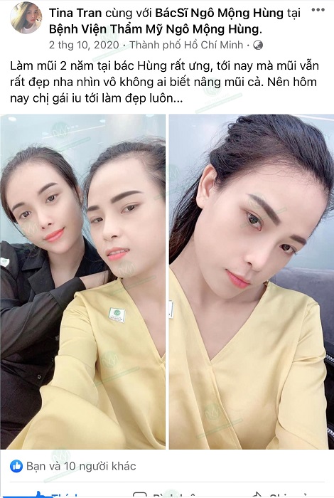 Lỗ mũi hếch lên