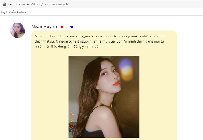 Lỗ mũi hếch lên