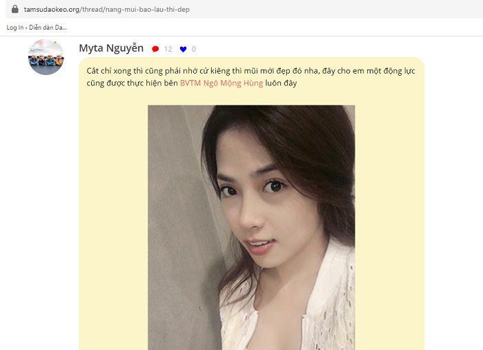 Khách hàng chia sẻ sau thẩm mỹ