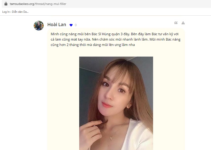 Cánh mũi hếch