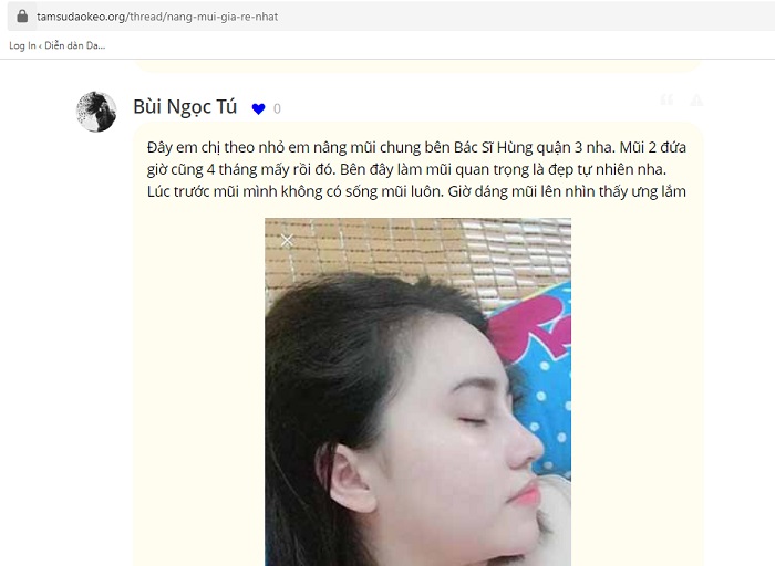 Cánh mũi hếch