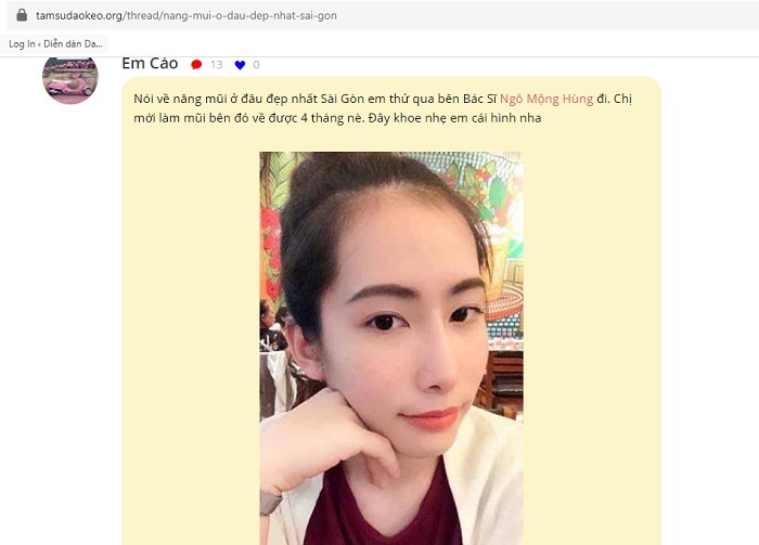 Mũi hơi tẹt
