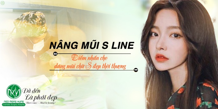 Nâng mũi S Line