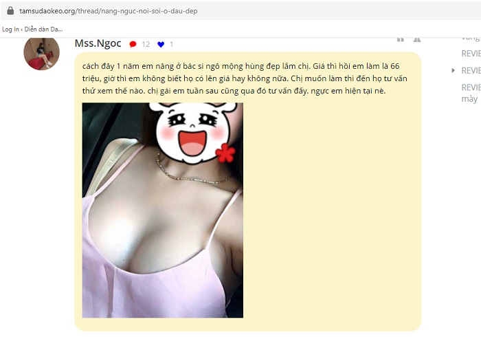 Nâng ngực có tự nhiên không