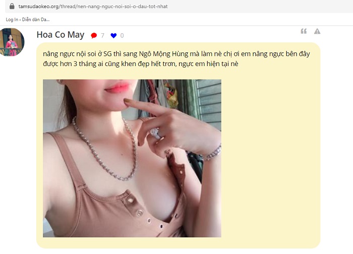 Nâng ngực gel