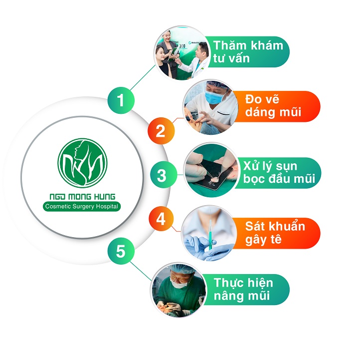 Nâng mũi bọc sụn có đẹp không