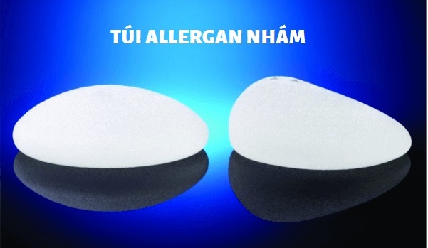Ngoài túi ngực Arion thì hiện nay có các loại túi ngực nào?