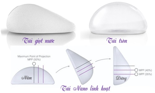 Các ưu điểm “CỰC CHẤT” của túi ngực Ergonomix 