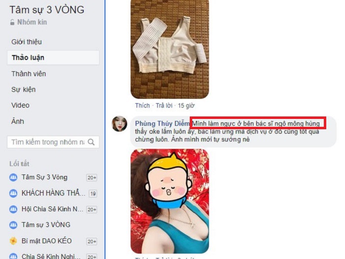 Nâng ngực cỡ 350