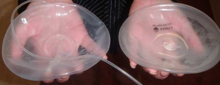 Các thông tin bạn nên biết về túi ngực nước biển 