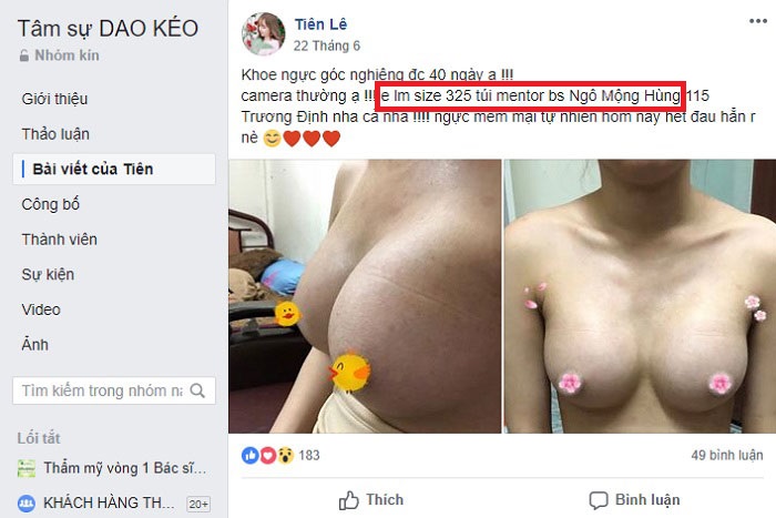 Túi ngực Sebbin siêu nhám