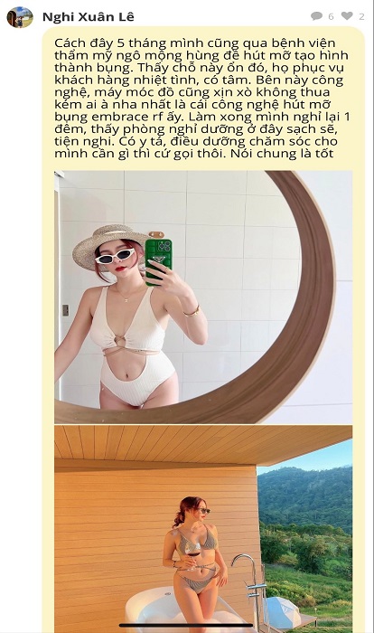 Có nên đi hút mỡ bụng không các mẹ