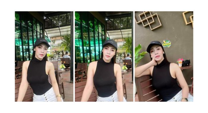 Hút mỡ bụng ở bệnh viện nào tốt