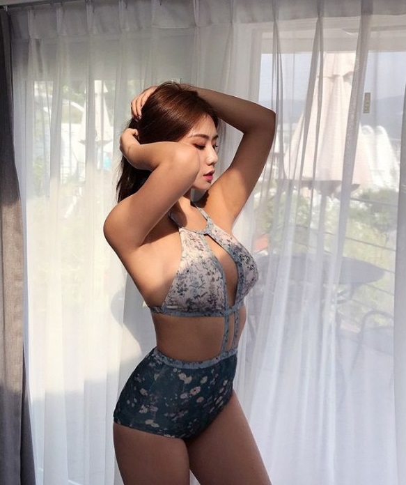 Hút mỡ bụng sau 1 tháng