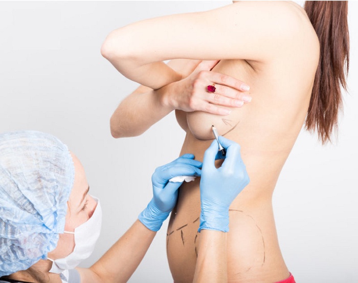Nâng ngực chảy xệ có nguy hiểm không