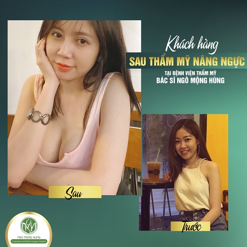 Ngực to ngực nhỏ có sao ko