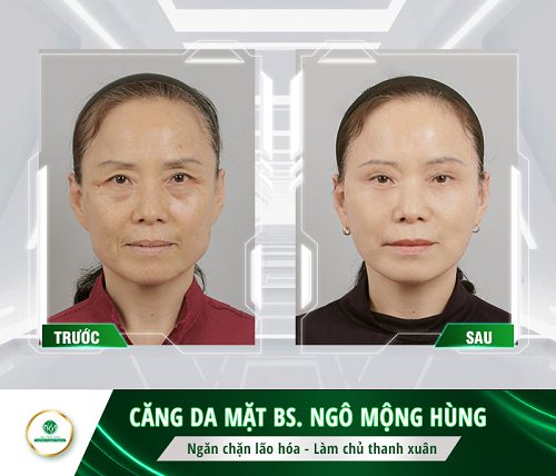 kem làm trắng da mặt của nhật