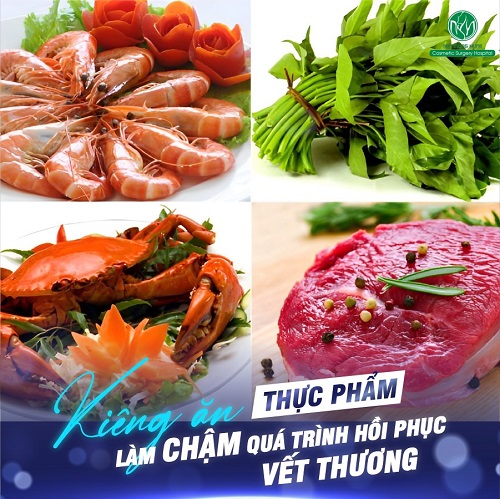 lưu ý khi cấy chỉ