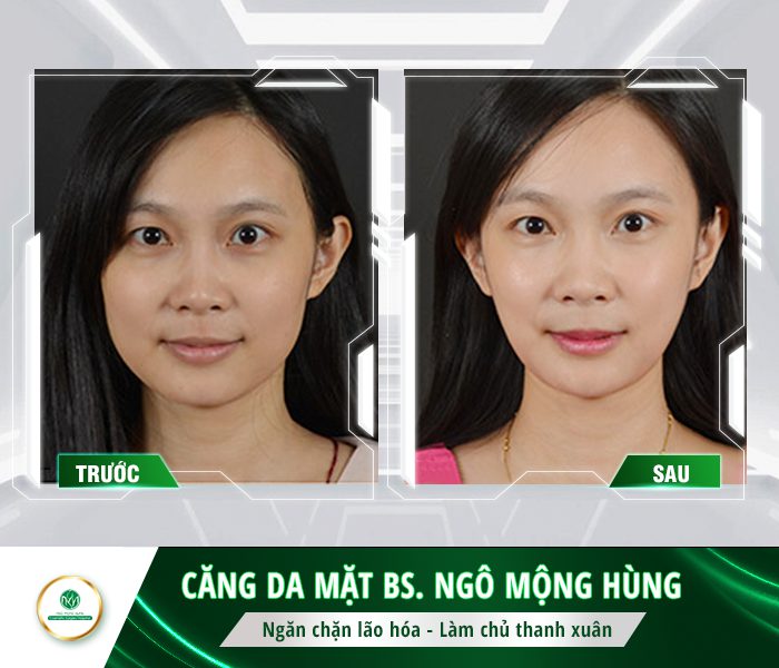 mặt nạ làm trắng da bằng bia mặt nạ làm trắng da bằng bia