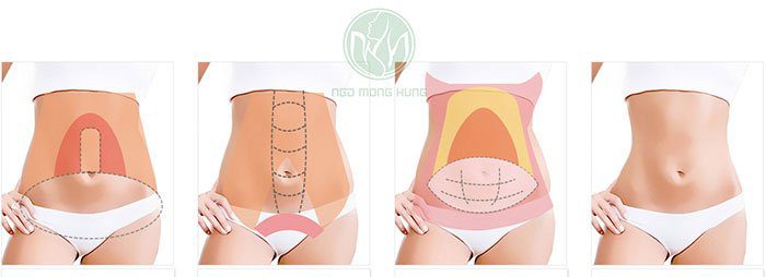 Uống nước gừng mật ong có giảm mỡ bụng không